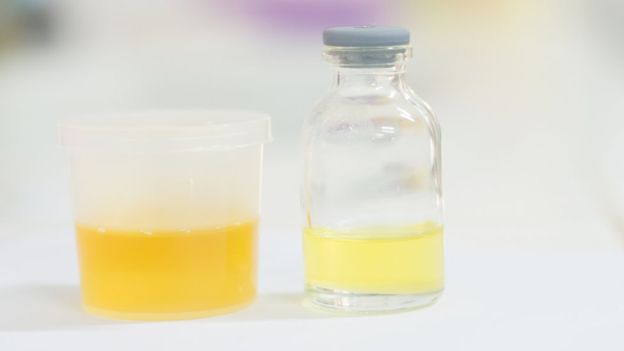 Urine test reveals what you really eat