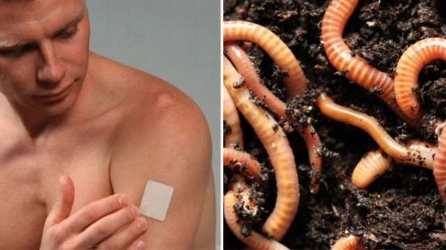 Cyber-attack glossary: What are malware, patches and worms?
