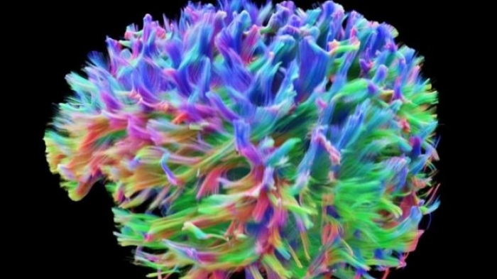 What the brain's wiring looks like