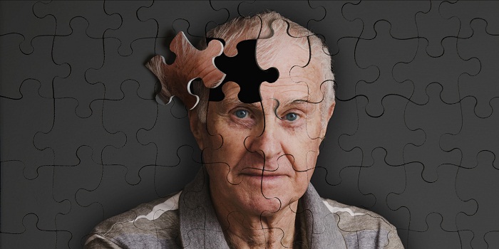 Alzheimer aurait un lien avec la santé bucco-dentaire