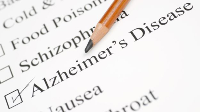 Young alzheimer`s risk carriers show altered brain function