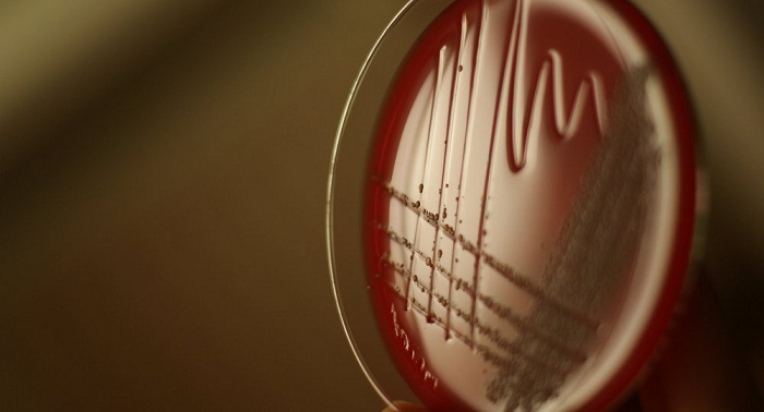Antibiotika-Resistente Bakterien breiten sich aus–Droht der Menschheit eine Seuche?  