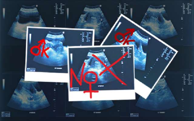 Azerbaijan may ban baby gender determination