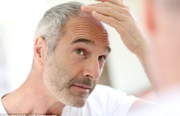 Skin cell discovery could spell cure for baldness and grey hair