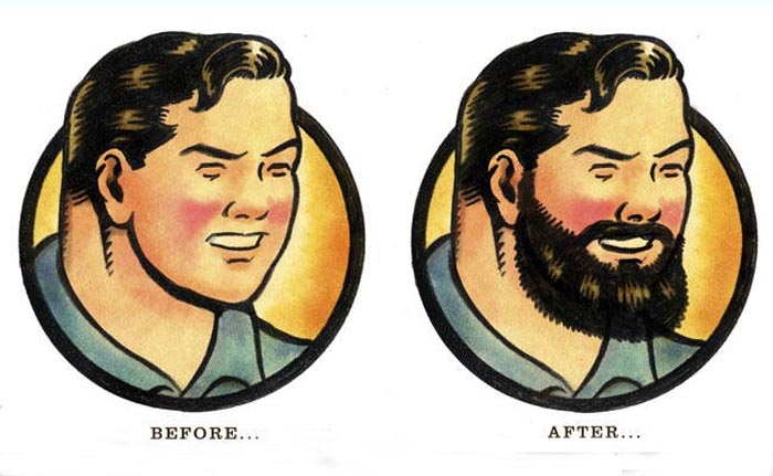 Baby-faced men opt for beard transplants