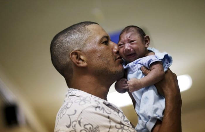 Nervous system birth defects 20 times likelier for Zika-hit mothers, study finds
