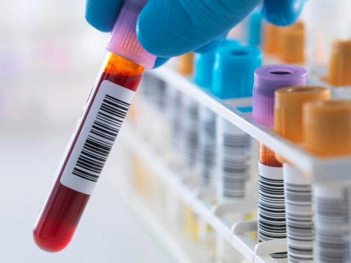 New blood test could help Ppredict one