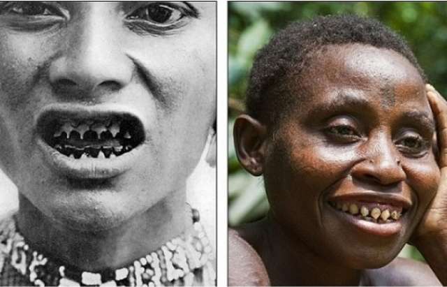 Sharpened Teeth Body Modification