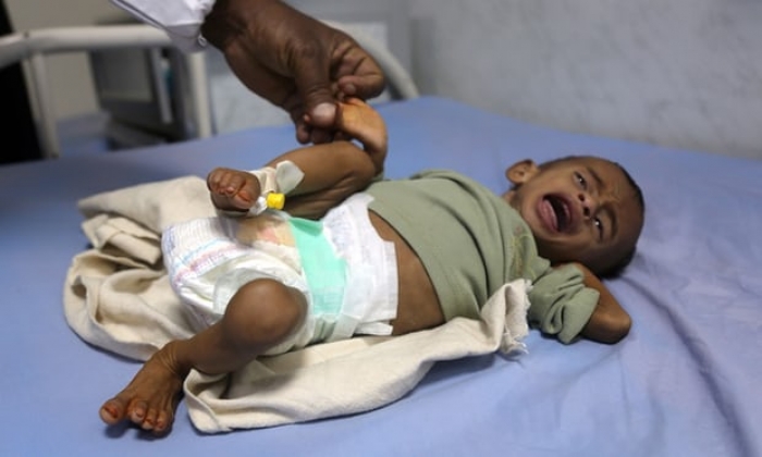 Yemen war: 5,000 children dead or hurt and 400,000 malnourished, UN says