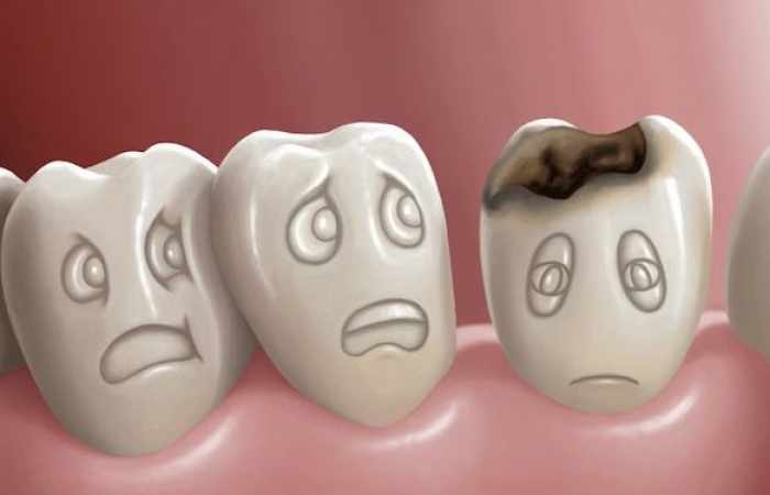 Voici comment ne plus jamais avoir de caries !