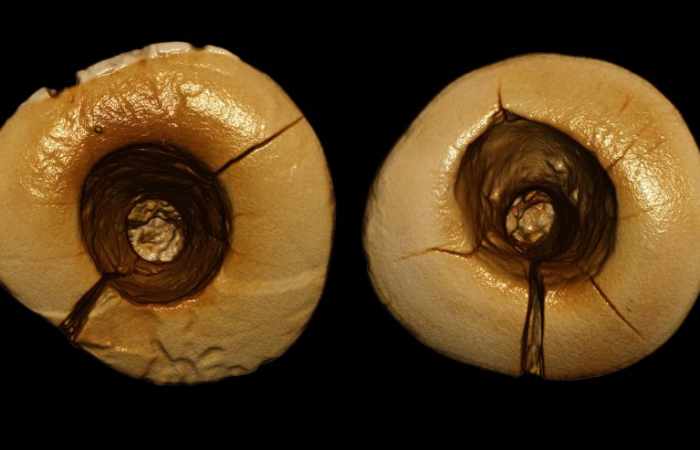 Earliest dental fillings discovered in 13,000-year-old skeleton