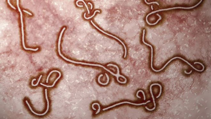 Ebola lingers in semen for nine months