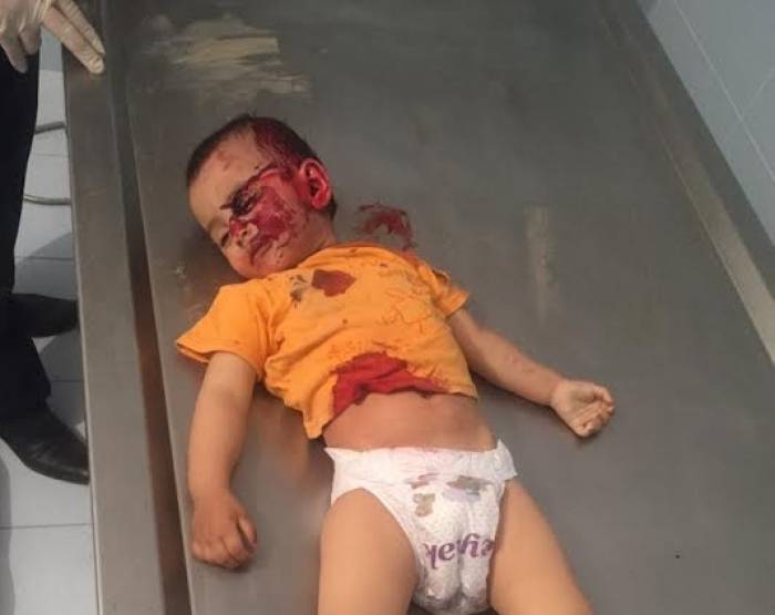 La preuve des atrocités arméniennes – les photos de Zahra, enfant de 2 ans tué - +18 PHOTOS