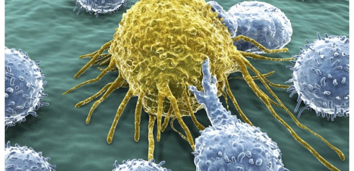 7 idées reçues sur le cancer