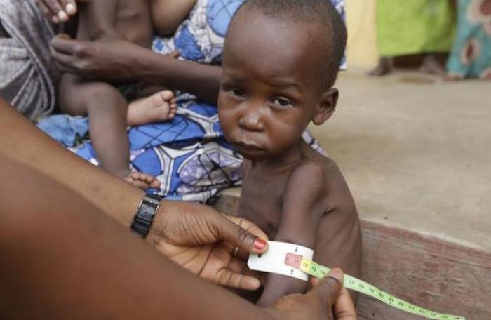 5,7 millions d'enfants menacés par la famine
