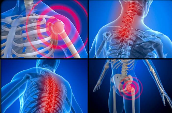 Journée mondiale de la fibromyalgie: Quels sont les symptômes?