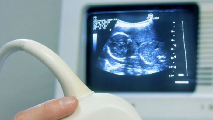 Freezing ovaries `safe option` for cancer sufferers