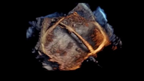 Revolutionary 4D images of human heart - VIDEO