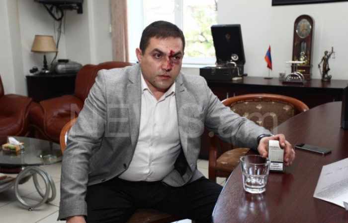 Fistfighting among Armenian lawyers - Reasons revealed