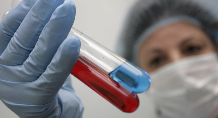 Scientists Claim They Found Natural Defense Against HIV  