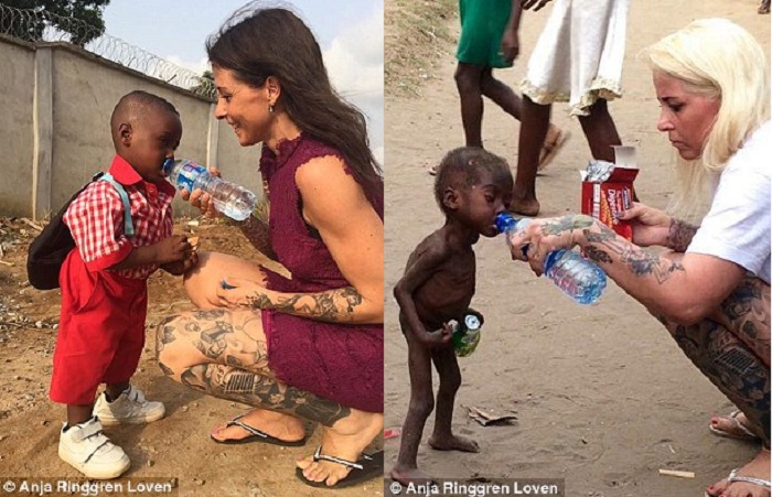 One year on, the little boy has made an amazing recovery