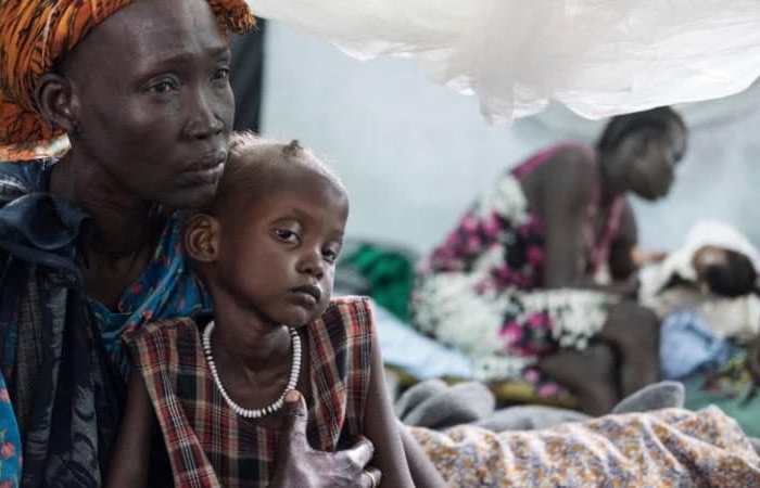 UN says world faces largest humanitarian crisis since 1945 with 20 million at risk of starvation