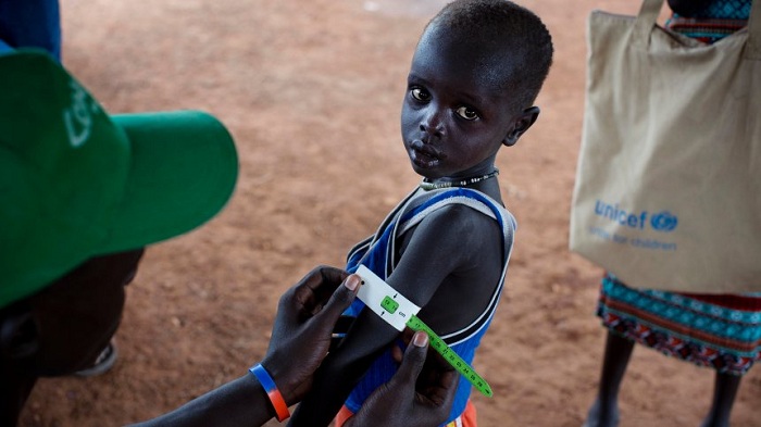 1,4 Millionen Kinder von Hungertod bedroht