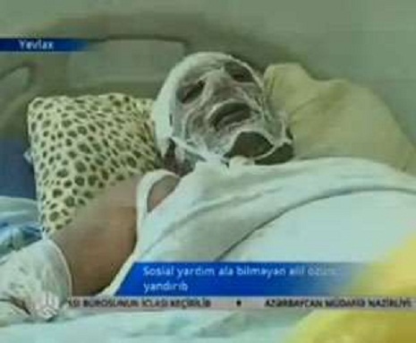 Özünü yandıran əlillə bağlı rəsmi açıqlama – VİDEO 