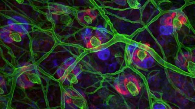 Working muscles grown in lab from skin stem cells in world first