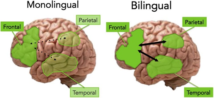 Speaking More Than One Language Eases Stroke Recovery