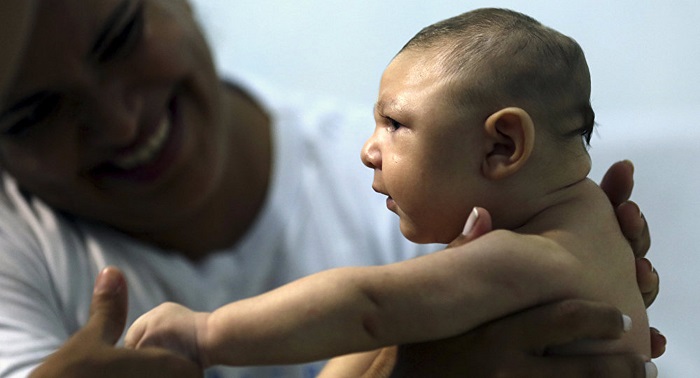 Over 2,000 children born with microcephaly in Brazil in 2016