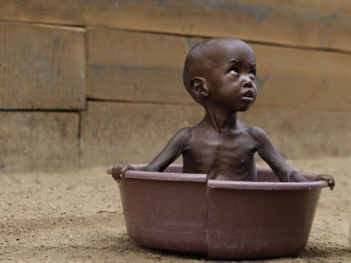 La famine refait surface en Somalie