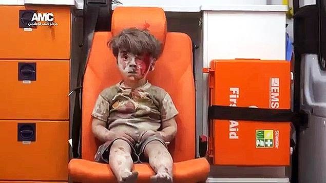 Omrane, 4 ans, symbole de la violence aveugle de la guerre en Syrie