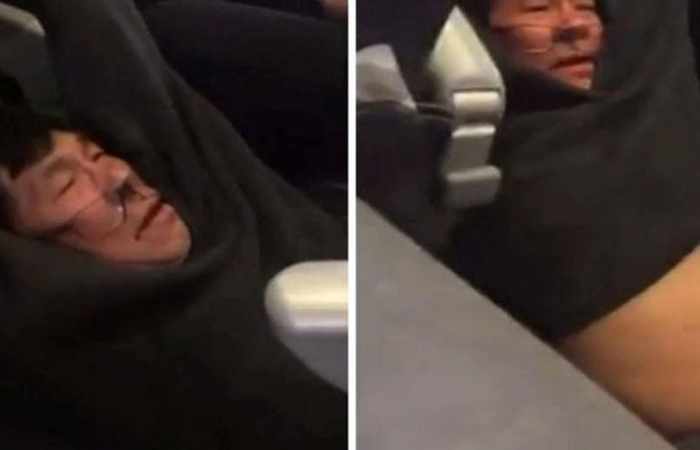 United Airlines faces mounting pressure over hospitalized passenger