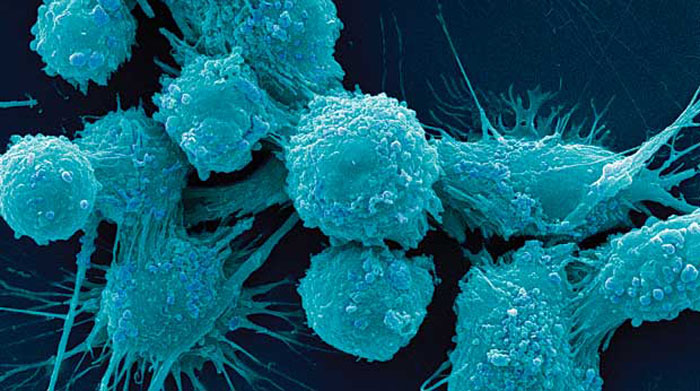 Researchers develop new method to trap cancer cells