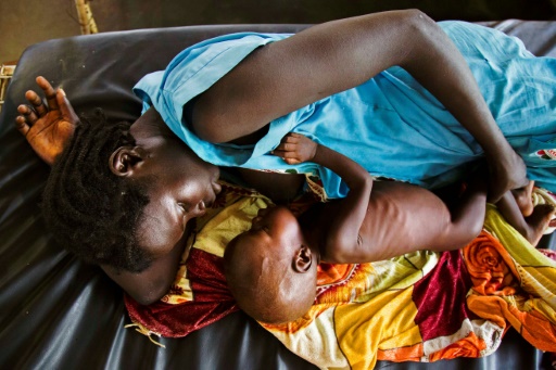 Burkina : un demi-million d`enfants souffrent de la malnutrition aiguë