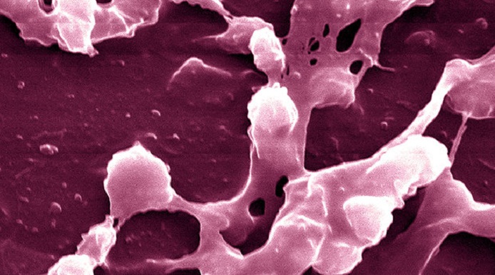 Antibiotics May Make `Superbug` MRSA Stronger