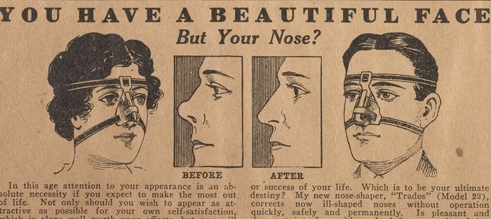 Ugly history of cosmetic surgery