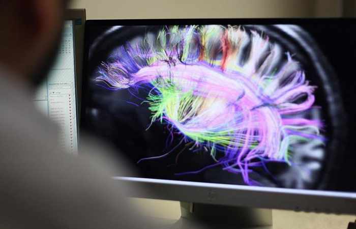 US scientists grow ‘minibrains’ in lab
