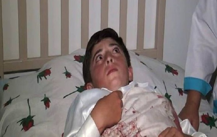 أصيب حالة صحية صبي في نتيجة استفزاز الأرمن- فيديو

