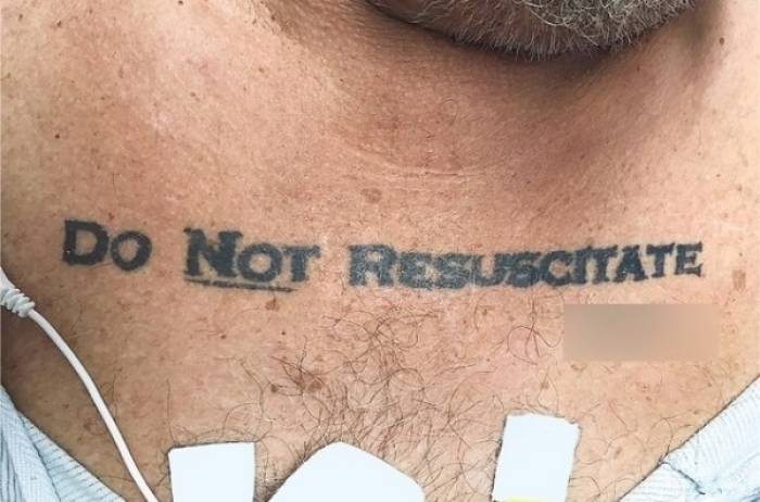 Etats-Unis: un hôpital obéit à un ordre de "ne pas réanimer" tatoué sur un patient