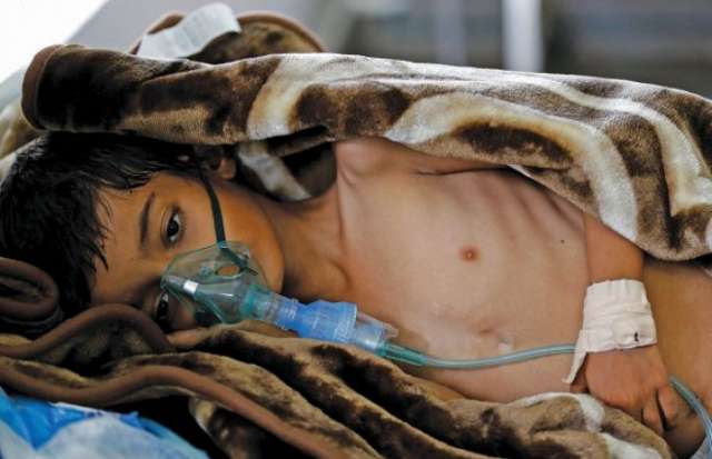 وفيات الكوليرا في اليمن تناهز الألف