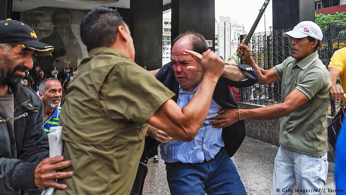 Opposition leader hit with pipe in Venezuela