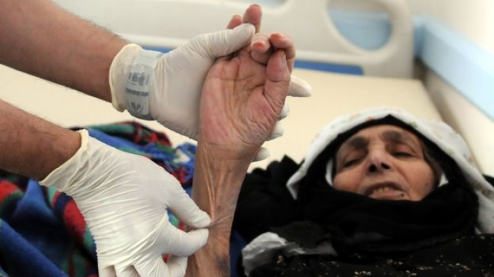 Yemen cholera cases pass 100,000 amid 'unprecedented' epidemic