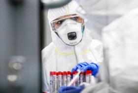 Rusiyada koronavirusdan daha 397 nəfər ölüb