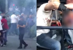    Ermənistan prezidenti zorakılıq edən polislərin tərəfini saxladı   
