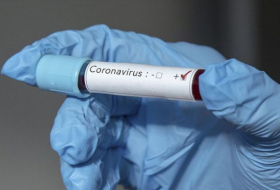  Azərbaycanda daha 165 nəfər koronavirusa yoluxdu, 2 nəfər öldü 