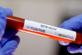 Gürcüstanda koronavirusa yoluxma sayı 1500-ü ötdü
