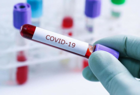 İranda koronavirusdan daha 129 nəfər ölüb