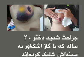    İran polisi 20 yaşlı qızı sinəsindən güllələdi -    FOTO      